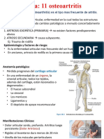 Tema OSTEOARTRITIS