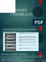 Lesiones Cerebrales