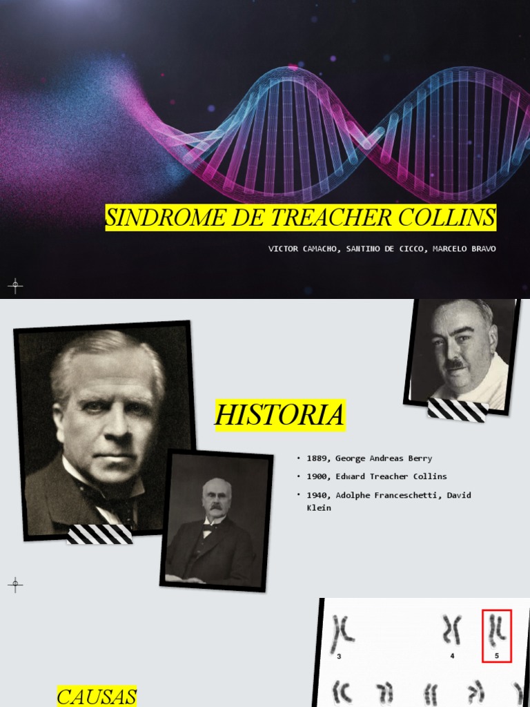 Síndrome de Treacher Collins: Causas y Tratamiento | PDF