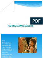 Faringoamigdalitis