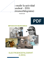 Cómo Medir La Actividad Cerebral - EEG (Electroencefalograma)