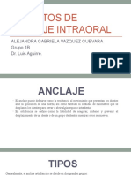 Aparatos de Anclaje Intraoral: Alejandra Gabriela Vazquez Guevara Grupo 1B Dr. Luis Aguirre