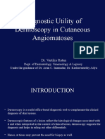 Diagnositic Utility of Dermoscopy in Cutaneous Angiomatoses
