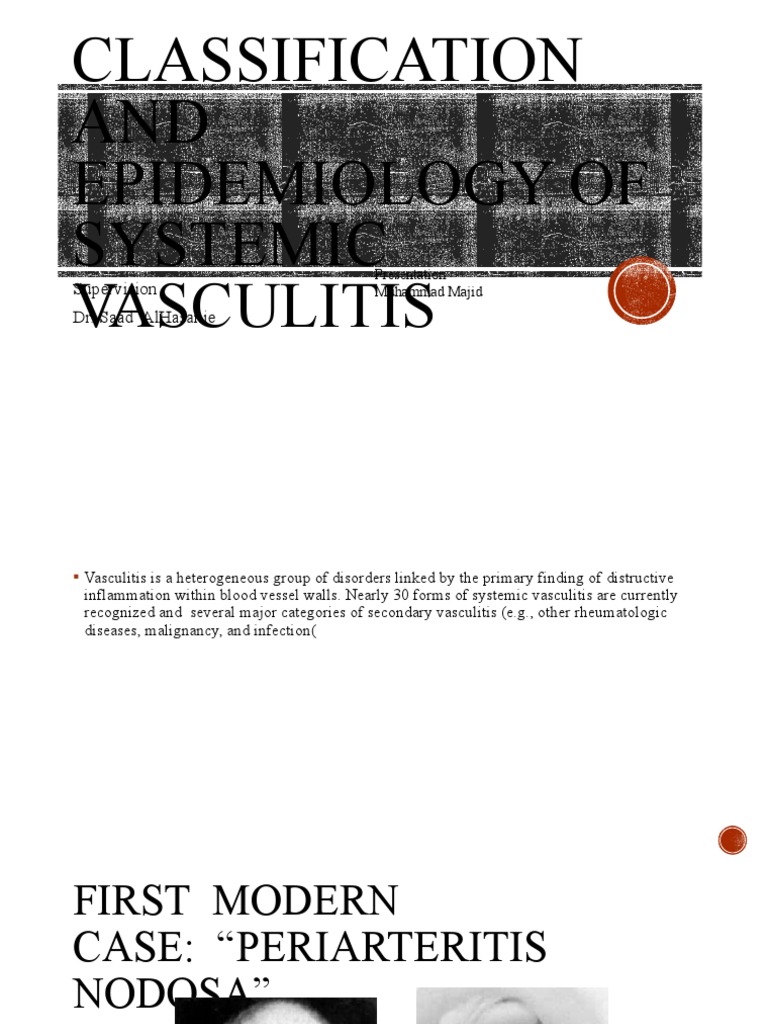 Classification and epidemiology of systemic vasculitis supervision dr