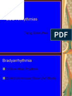 ECG-Arrhythmias: Tiang Soon Wee