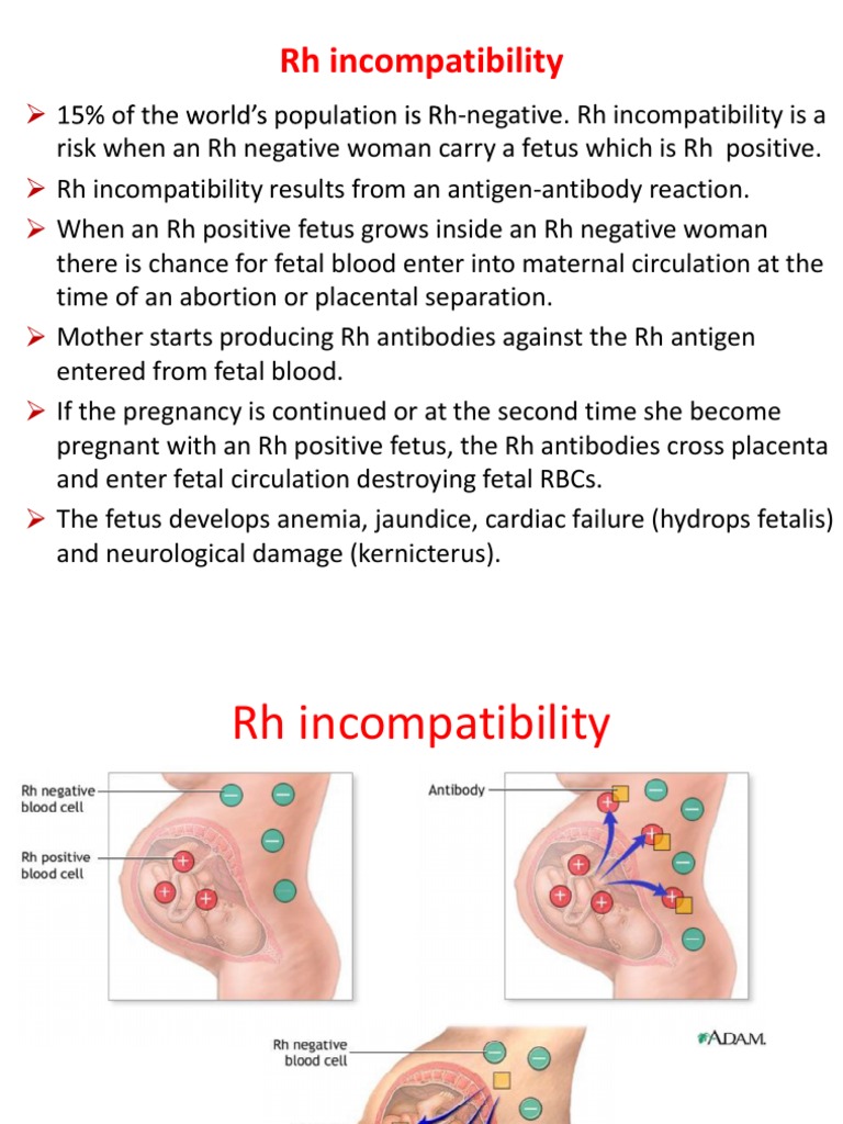 Rh Sensitization And Abo Incompatibility Flashcards – ZODLGP