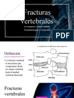 Fracturas vertebrales: diagnóstico y tratamiento