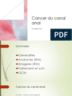 Cancer du canal anal