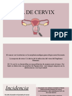 Ca de Cervix