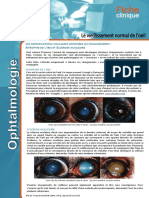 Es Modifications Oculaires Associées Au Vieillissement Trophie de L Iris Et Clérose Nucléaire