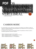 Cambios Modic Qué Son, Tipo y Diagnóstico InfoEspalda | PDF | Cirugía ...