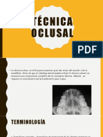 Técnica Oclusal