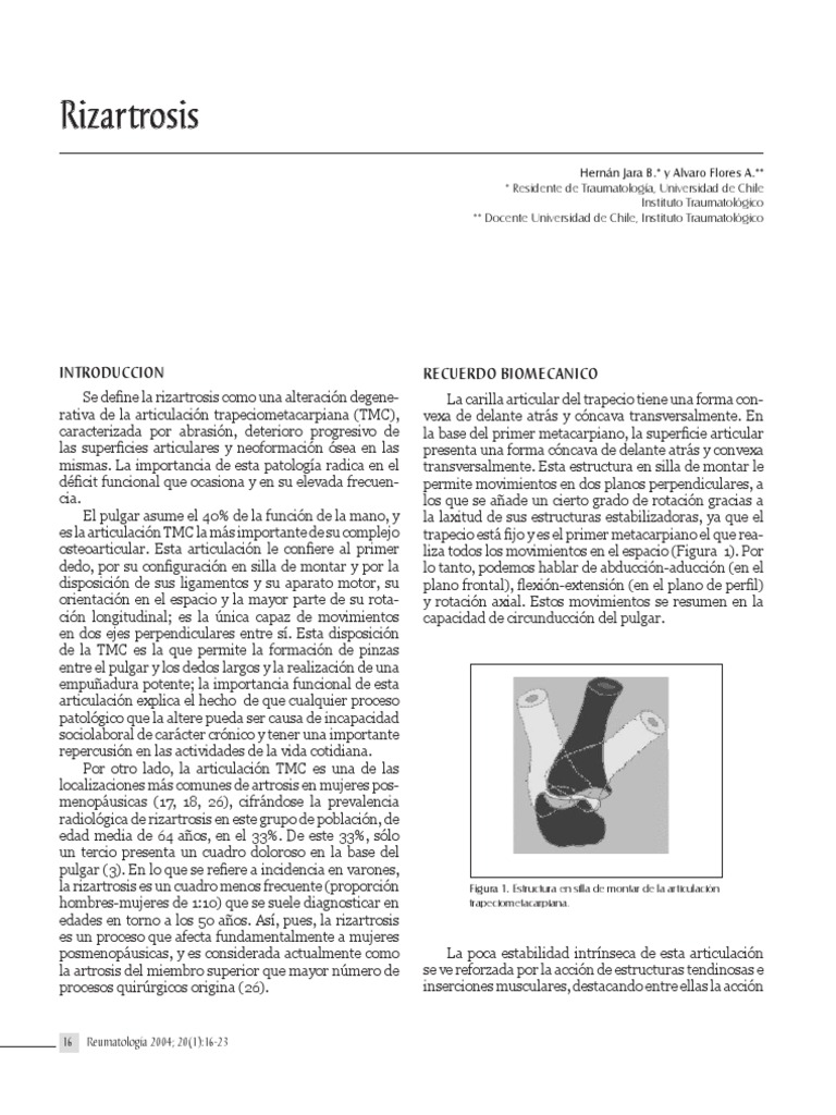 Rizartrosis: Diagnóstico y Tratamiento | PDF | Medicina CLINICA ...
