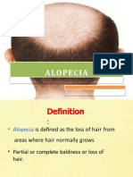 alopecia-160716052003