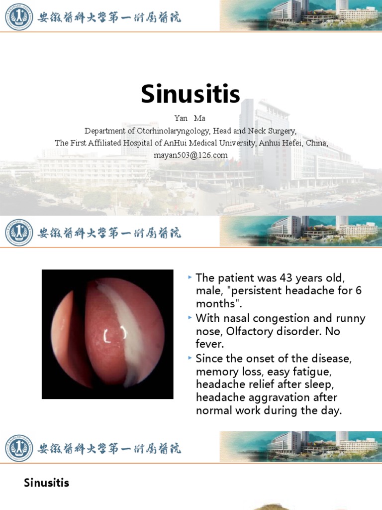 Understanding Sinusitis: Symptoms and Treatment | PDF