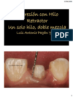 Hilo Retractor