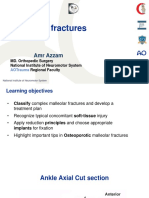 Malleolar Fractures 17