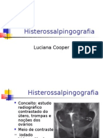 Histerossalpingografia