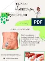 Presentación Sobre Yeyunostomia y Formulas Enterales