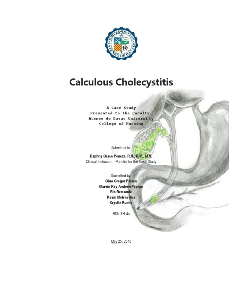 Cholelithiasis case study scribd image
