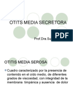 Otits Media Secretora