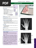 RX de Mano Frente | PDF | Mano | Anatomía