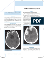 Multiple Meningiomas