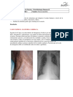 Informe Sobre Electrocardiografía