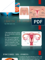 Cancer de Ovario - Nac