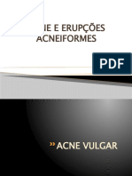 Acne e Erupções Acneiformes