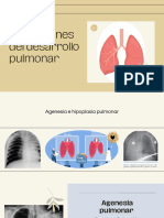 Agenesia e Hipoplasia Pulmonar