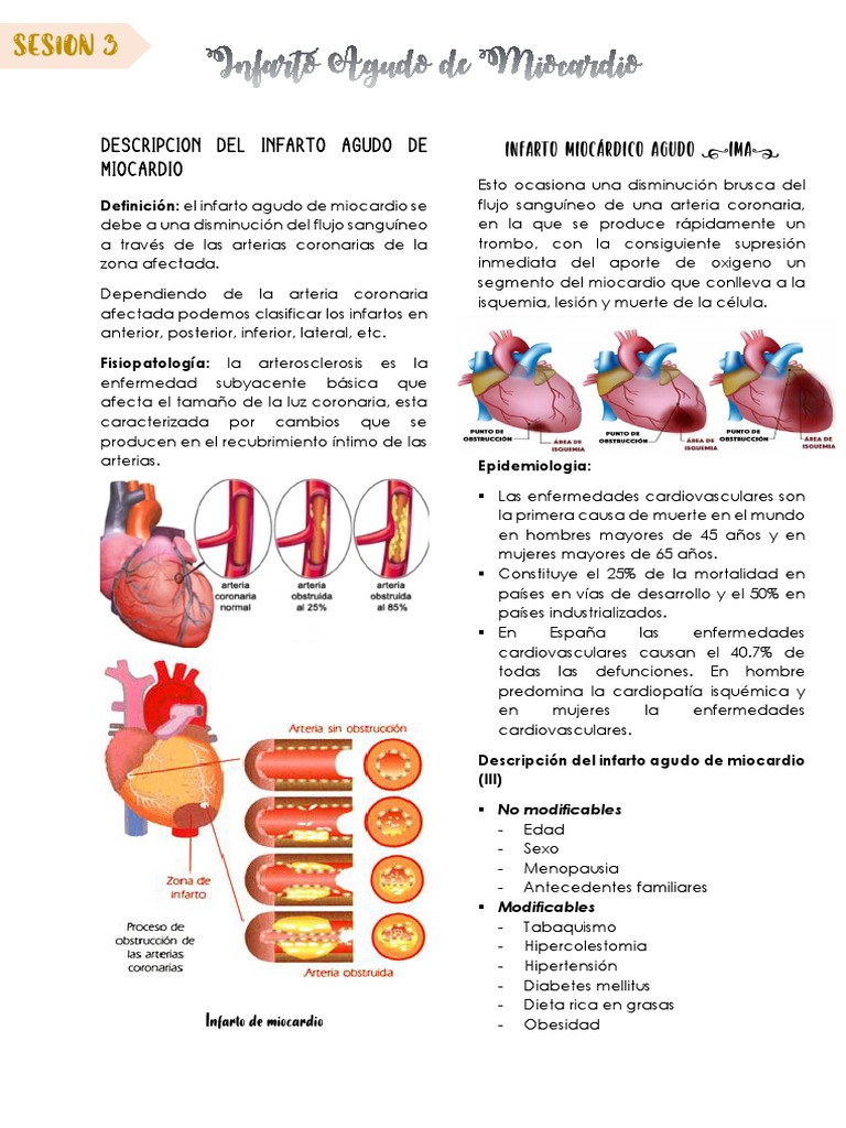 Fisiopatología del Infarto Agudo de Miocardio | PDF | Hipertensión ...