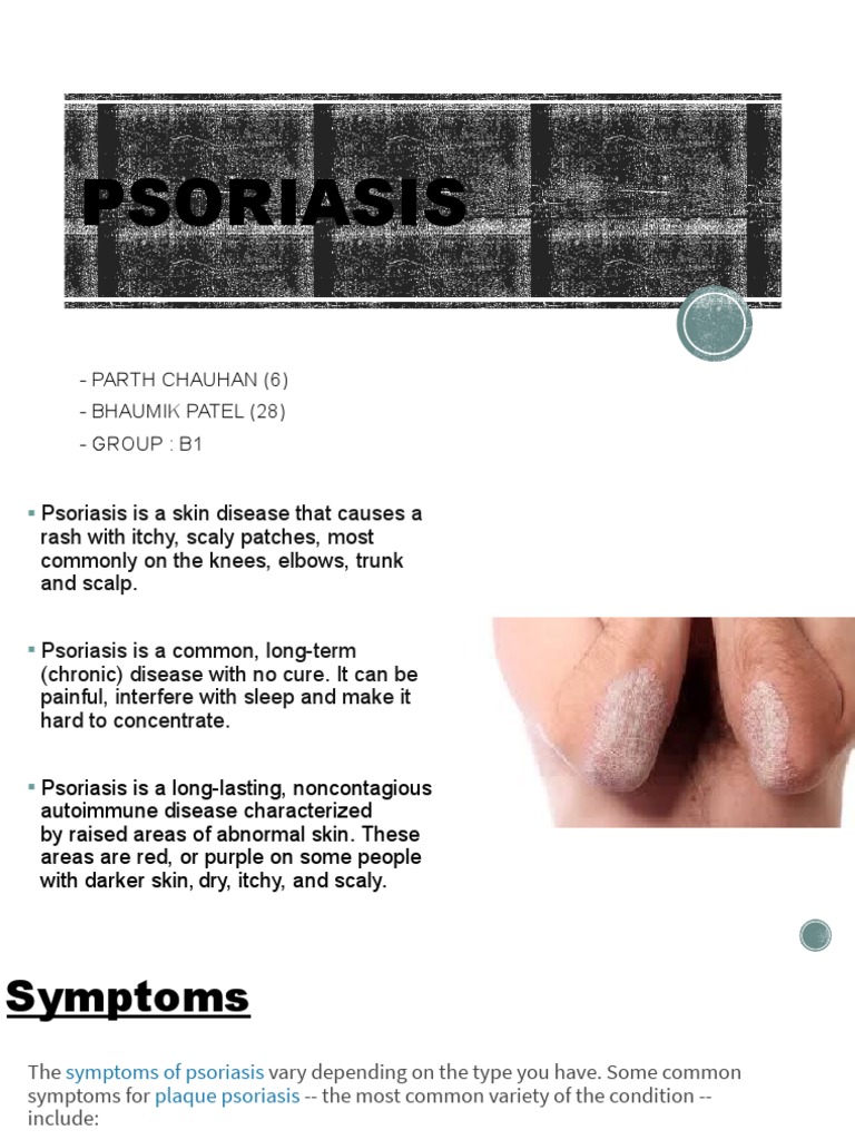 psoriasis-parth-chauhan-6-bhaumik-patel-28-group-b1-pdf