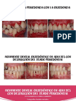 Relación de La Periodoncia Con La Ortodoncia