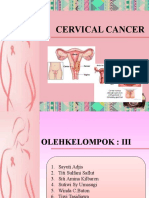 Cervical Cancer Causes, Symptoms and Prevention