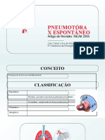 Pneumotóra X Espontâneo: Artigo de Revisão: NEJM 2000