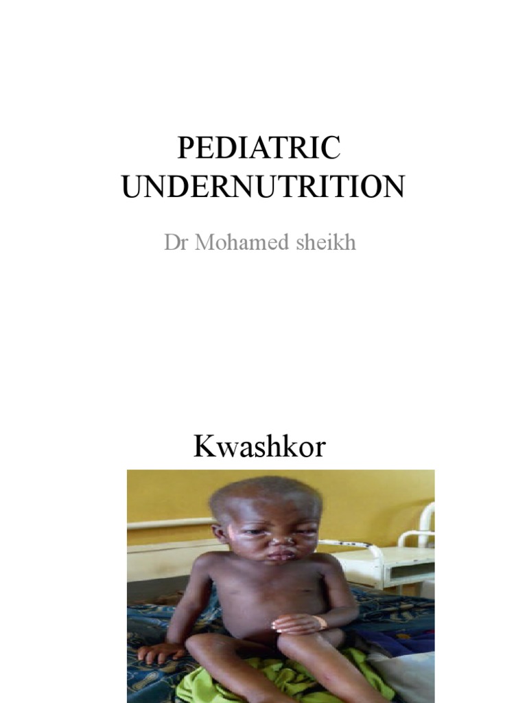 Understanding Pediatric Malnutrition Causes, Types, Assessment