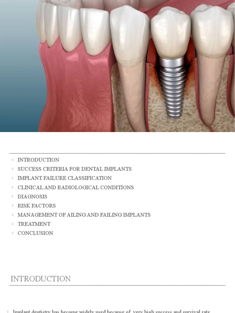 Implant Failure and Their Management | PDF | Dental Implant | Osteoporosis