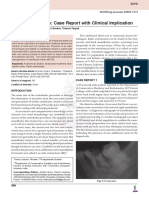 Radix Entomolaris: Case Report With Clinical Implication: 10.5005/jp-Journals-10005-1572