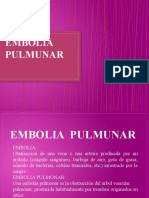 Embolia Pulmunar