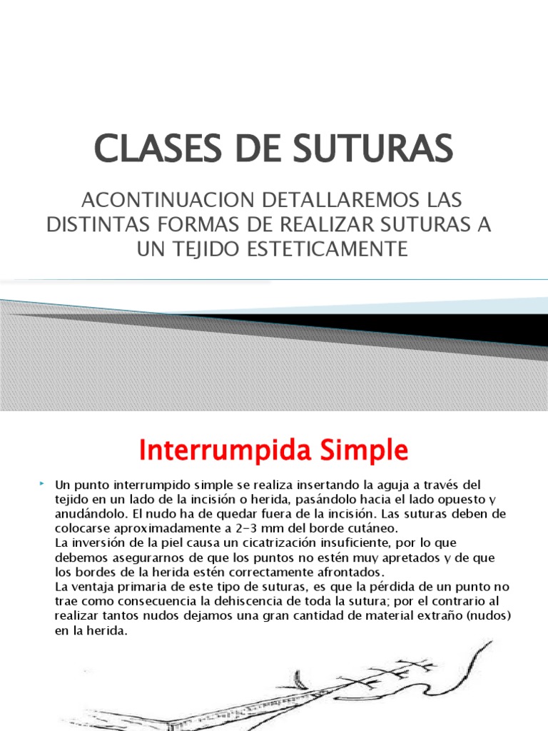 Clases De Suturas Pdf Sutura Quirúrgica