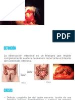 Oclusión Intestinal 