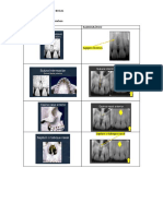 Radiografía Periapical