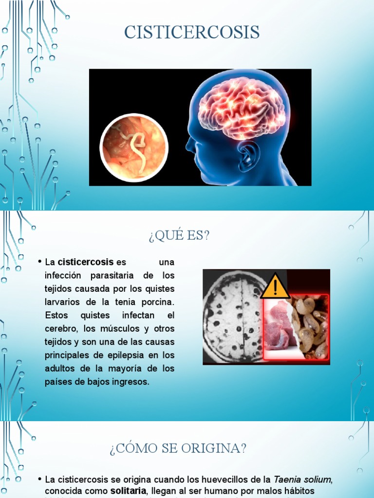 Cisticercosis | PDF | Medicina CLINICA | Especialidades Medicas
