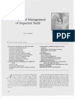 Principles of Management of Impacted Teeth: Larry