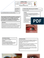 Boletin Hemorragia Subconjuntival