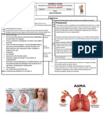 ASMA PULMONAR: SÍNTOMAS, CAUSAS Y PREVENCIÓN