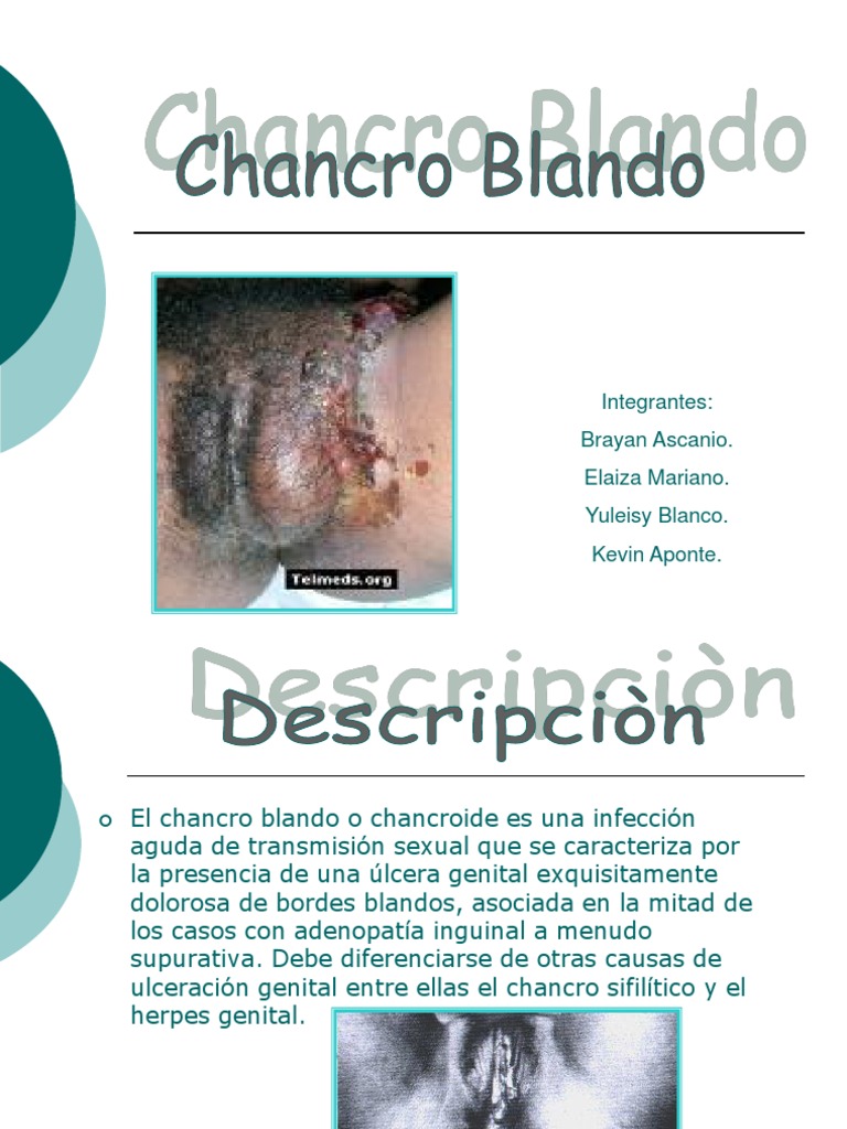 Chancroide: Síntomas y Tratamiento | PDF