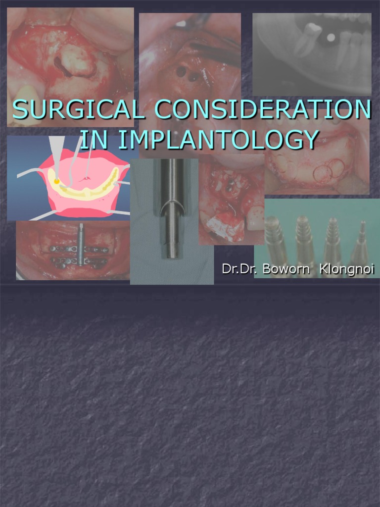 Surgical Considerations in Implantology | PDF | Dental Implant | Bone