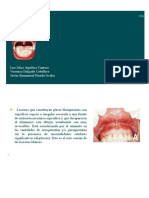 Queratosis o Placa: Definición